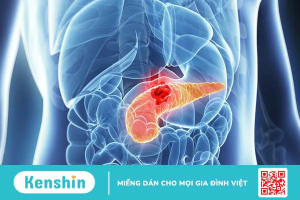 Suy giảm chức năng tế bào beta và tiểu đường type 2 1