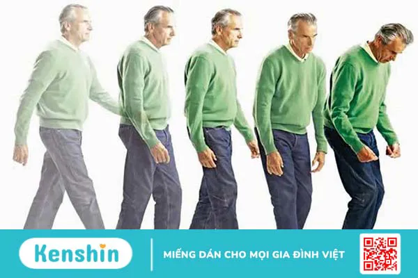 Suy giảm trí nhớ ở bệnh Parkinson: Dấu hiệu nhận biết, yếu tố ảnh hưởng và điều trị 3