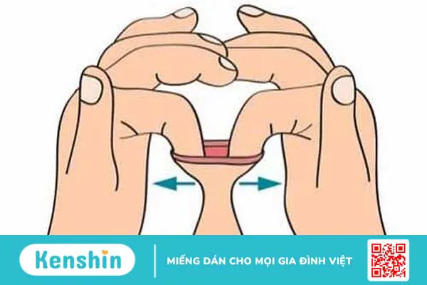 Tách dính bao quy đầu tại nhà: Cách làm an toàn và hiệu quả 3