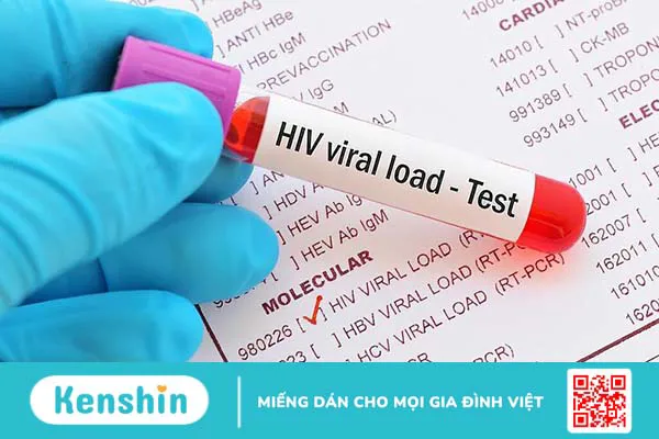 Tải lượng virus là gì? Khi nào cần thực hiện xét nghiệm tải lượng virus?