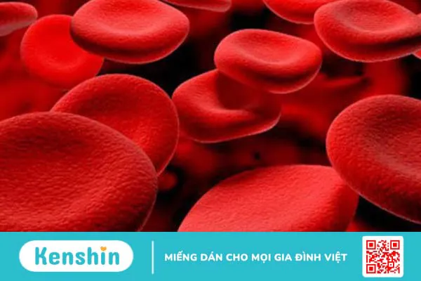 Tại sao cần sàng lọc thalassemia? Các xét nghiệm giúp chẩn đoán bệnh thalassemia