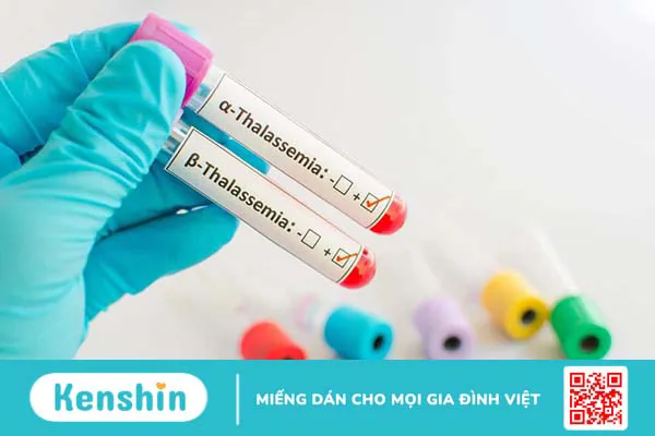 Tại sao cần sàng lọc thalassemia?3