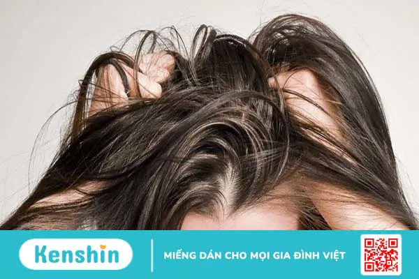 Tại sao gội đầu xong vẫn ngứa? Cách khắc phục hiệu quả