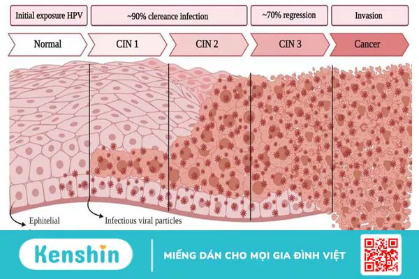 Tân sinh là gì? Tìm hiểu về bệnh lý tân sinh biểu mô cổ tử cung