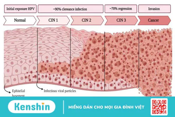 Tân sinh là gì? Tìm hiểu về bệnh lý tân sinh biểu mô cổ tử cung 1