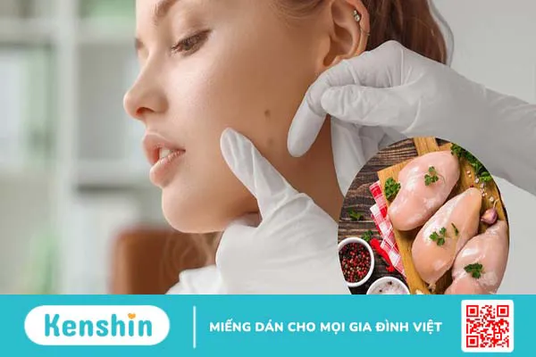 Tẩy nốt ruồi ăn thịt gà có sao không? Bao lâu thì ăn được thịt gà?