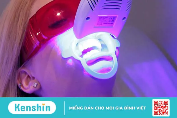Tẩy trắng răng bằng đèn Plasma có thực sự tốt?
