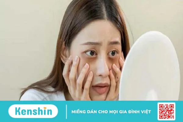 Thâm mắt bẩm sinh có chữa được không? Nguyên nhân và cách khắc phục tại nhà