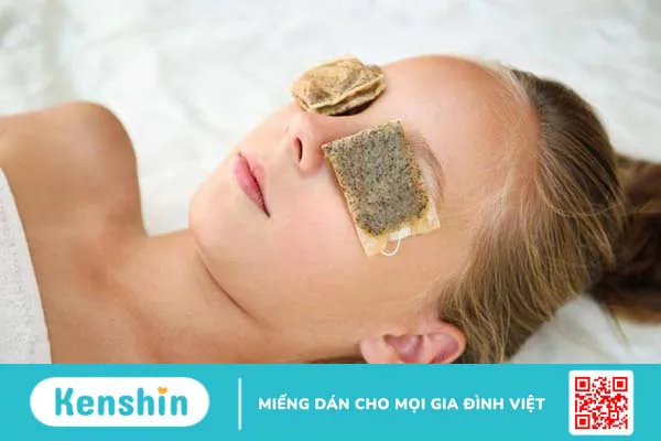 Thâm mắt bẩm sinh có chữa được không? Nguyên nhân và cách khắc phục tại nhà 3