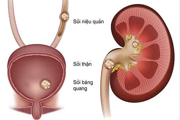 Thận: Cấu tạo, vai trò và một số bệnh lý thường gặp ở thận