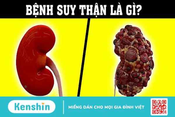 Thận: Cấu tạo, vai trò và một số bệnh lý thường gặp ở thận