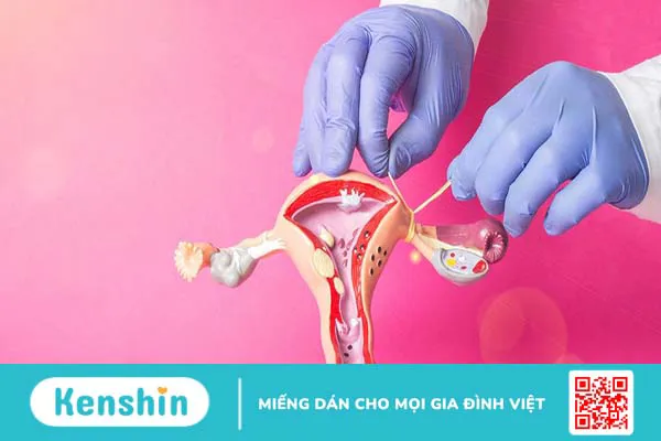 Thắt ống dẫn trứng có làm giảm ham muốn tình dục không?