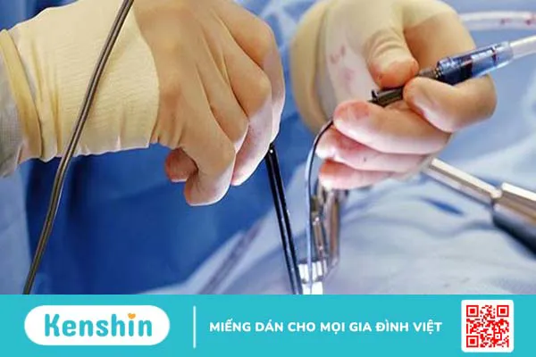 Thay van tim ở bệnh viện nào tốt nhất?