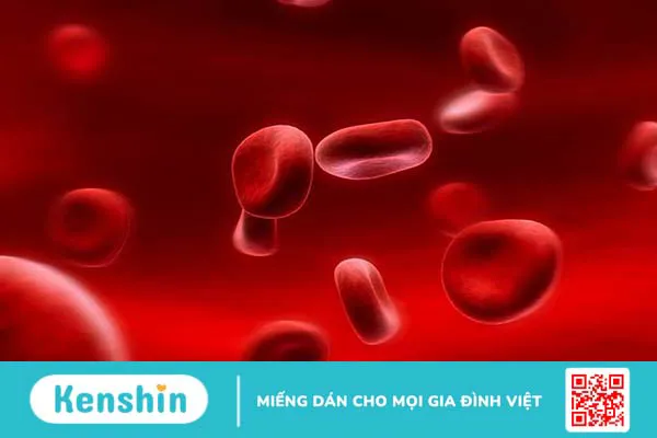 Thiếu máu hồng cầu nhỏ bẩm sinh có nguy hiểm không?