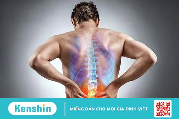 Thoát vị đĩa đệm nội xốp là bệnh gì? Cách phòng tránh và điều trị 2