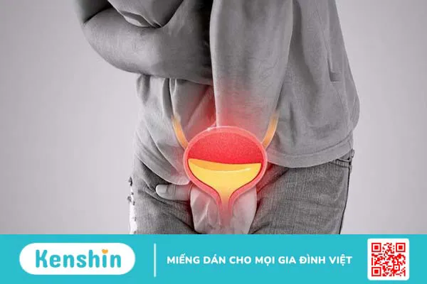 Thông tin về niệu đạo và phương pháp nong niệu đạo