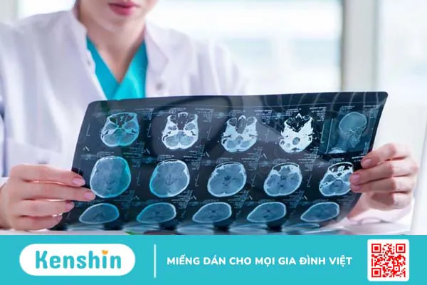 Thông tin về phản xạ của mắt và cách thực hiện kiểm tra kích thích phản xạ giác mạc