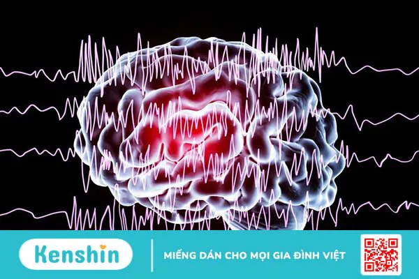 Thông tin về xét nghiệm gen cho bệnh động kinh phát hiện rối loạn di truyền hiệu quả