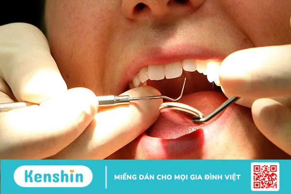 Thuốc diệt tuỷ răng là gì và một số lưu ý sau khi đặt thuốc