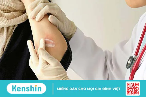 Thuốc mỡ là gì? Thuốc mỡ kháng sinh có tác dụng gì?