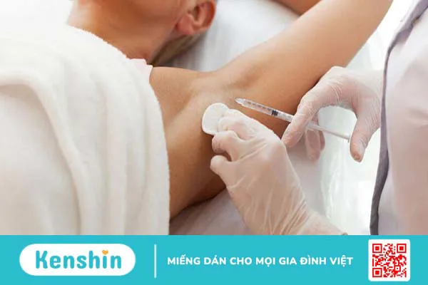 Tiêm botox trị hôi nách và những điều cần biết