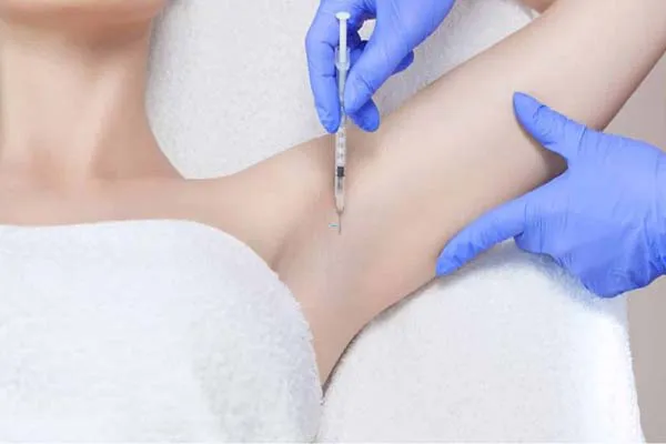 Tiêm botox trị hôi nách và những điều cần biết