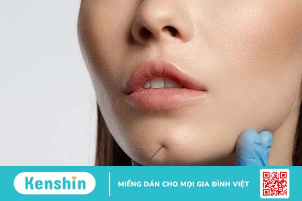 Tiêm tan filler cần kiêng gì? Nên ăn gì để hồi phục nhanh?