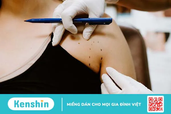 Tiêm tan mỡ nách: Những điều cần biết trước khi thực hiện