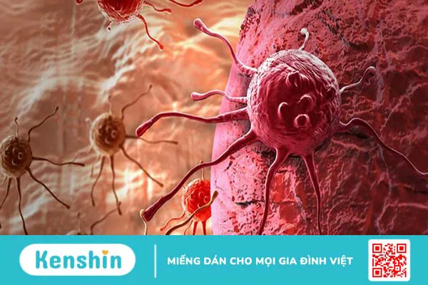 Tiền ung thư là gì? Dấu hiệu nhận biết giúp phát hiện sớm bệnh