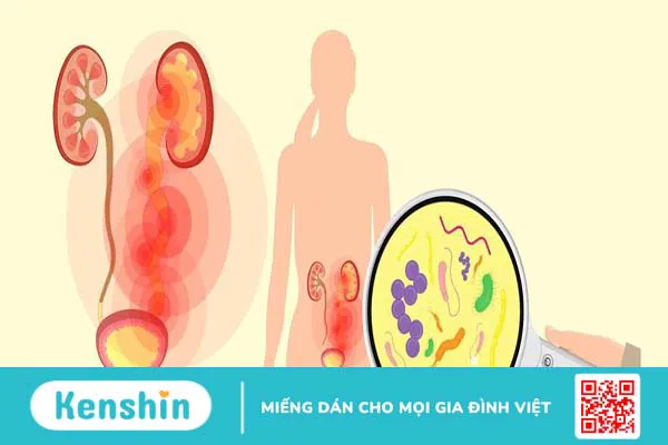 Tiểu máu vi thể: Nguyên nhân và cách điều trị 2