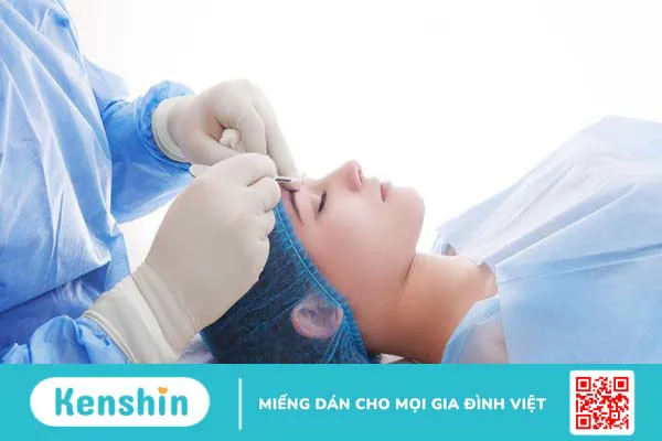 Tìm hiểu chi tiết về phẫu thuật cắt da thừa mi mắt