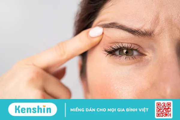 Tìm hiểu chi tiết về phẫu thuật cắt da thừa mi mắt 4