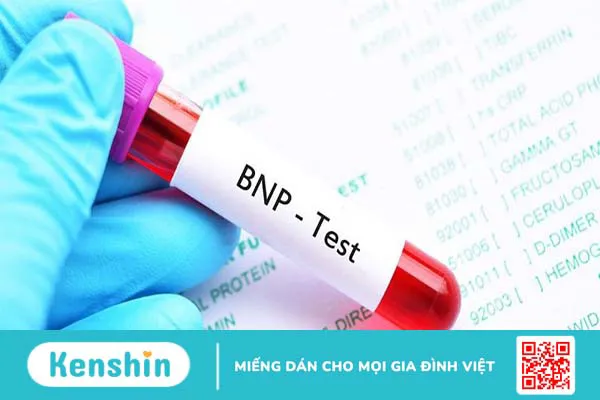 Tìm hiểu kỹ thuật đo BNP là gì? Trường hợp nào cần thực hiện đo BNP?