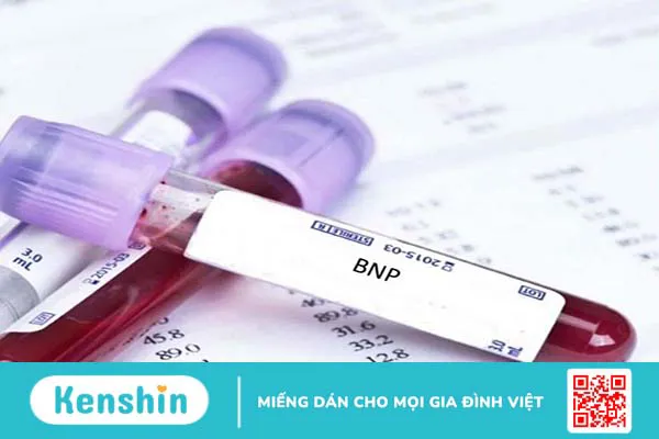 Tìm hiểu kỹ thuật đo BNP là gì? Trường hợp nào cần thực hiện đo BNP?