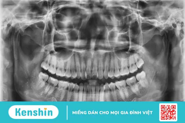 Tìm hiểu về bước sóng của tia X và ứng dụng của tia X trong y học