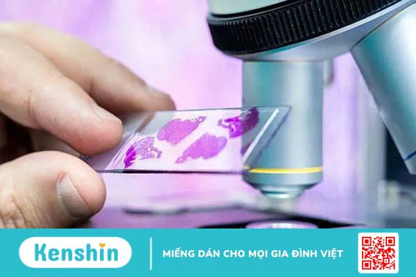 Tìm hiểu về kỹ thuật nhuộm hóa mô miễn dịch trong điều trị ung thư