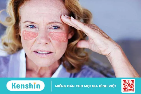 Tìm hiểu về phương pháp điều trị lupus ban đỏ bằng tế bào gốc 1