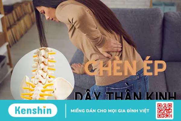 Tình trạng chèn ép dây thần kinh là gì? Cách nhận biết và phòng ngừa