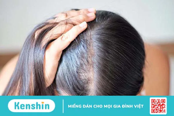 Tóc ít bẩm sinh thì phải làm sao để cải thiện?