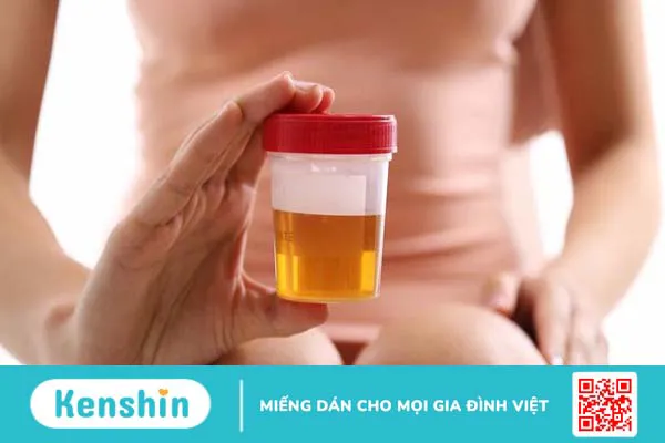 Tổng hợp các cách thải độc thận tại nhà an toàn và hiệu quả 2