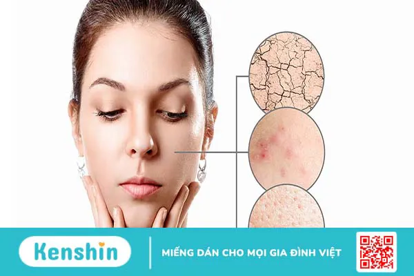 Tổng hợp các thành phần phục hồi da tốt nhất