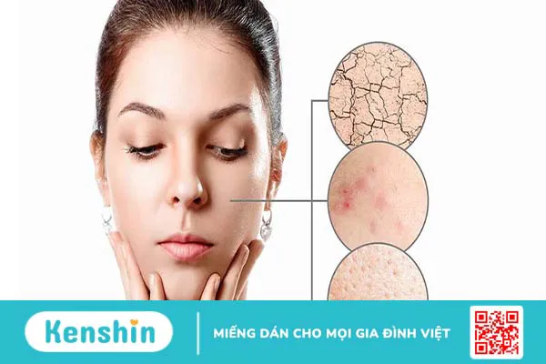 Tổng hợp các thành phần phục hồi da tốt nhất