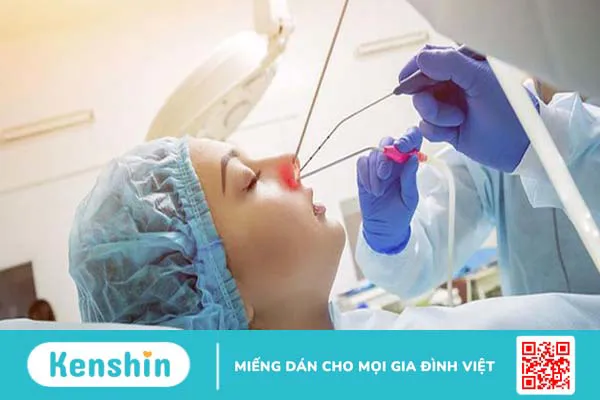 Tổng quan về phương pháp mổ xoang và những biến chứng có thể gặp