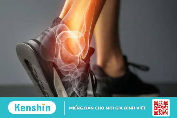 Tràn dịch khớp cổ chân là bệnh lý gì? Có nguy hiểm không?
