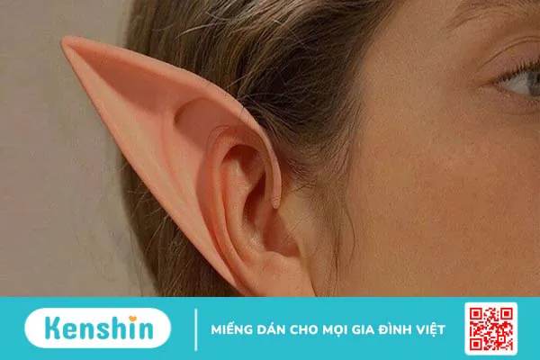 Trào lưu phẫu thuật tai yêu tinh tiềm ẩn nhiều rủi ro