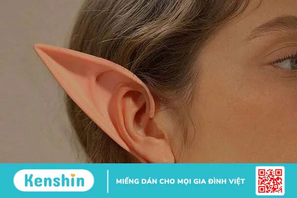 Trào lưu phẫu thuật tai yêu tinh tiềm ẩn nhiều rủi ro