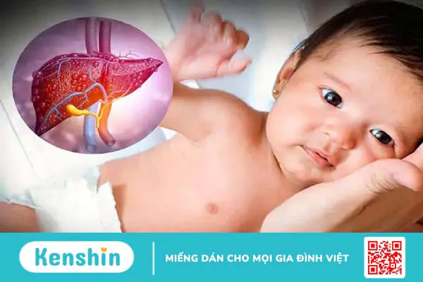 Trẻ mấy tháng uống vitamin A? Cách uống vitamin A đúng cách cho trẻ 4