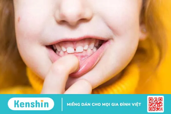 Trẻ sơ sinh hay bặm môi dưới có sao không? Cách trị trẻ hay bặm môi dưới 3