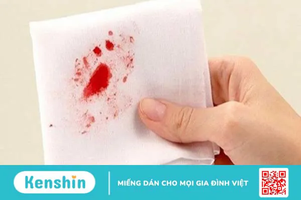 Trĩ hỗn hợp: Nguyên nhân, triệu chứng và cách điều trị 2