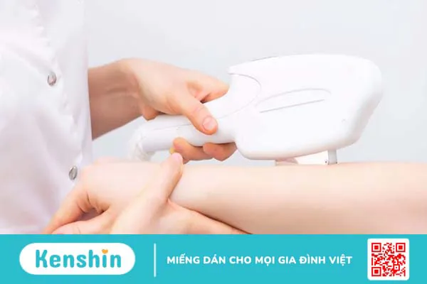 Triệt lông lạnh có ưu điểm gì?